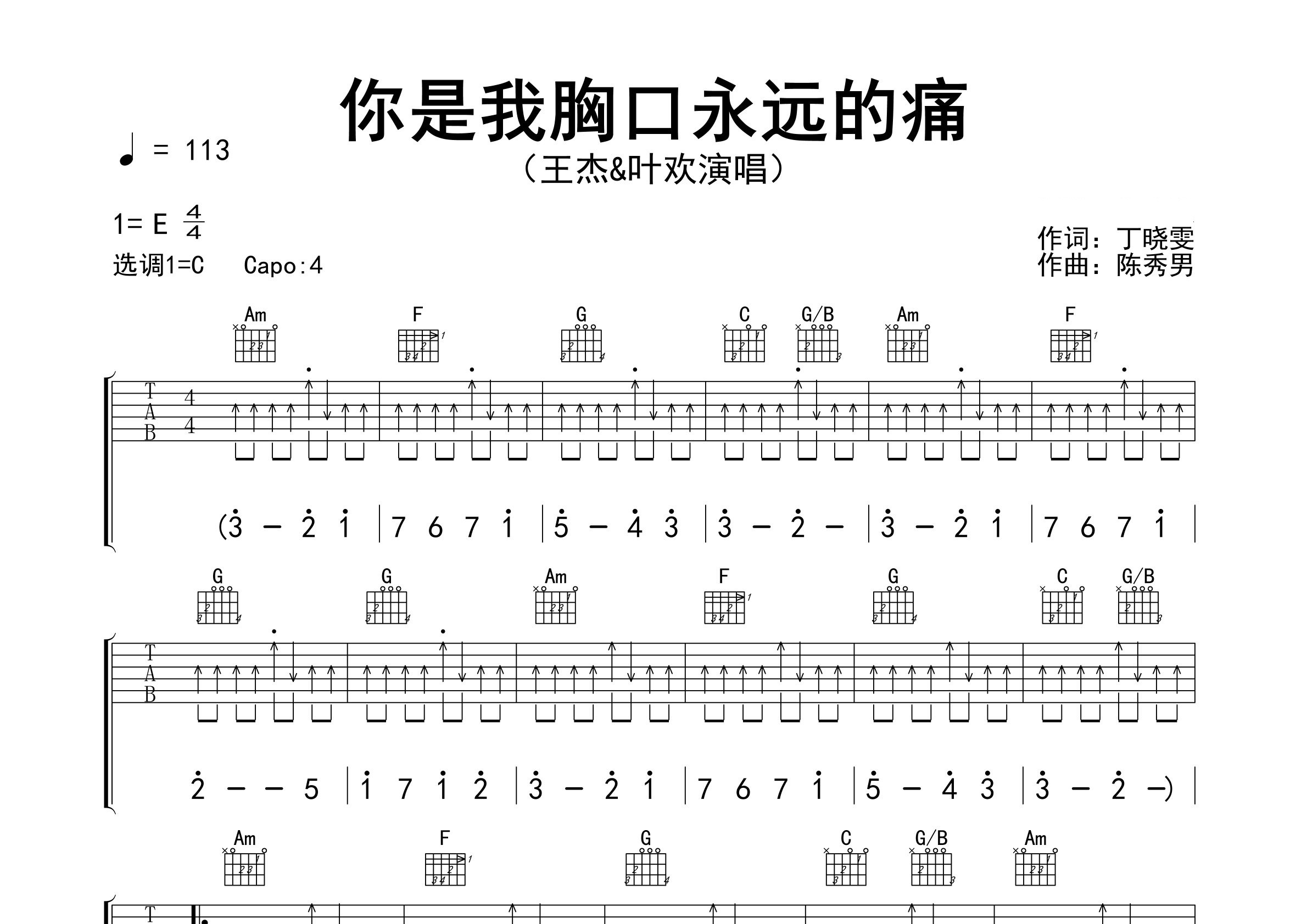 你是我胸口永远的痛吉他谱预览图